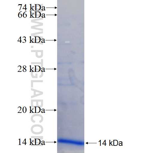 CYB561 fusion protein Ag24393 SDS-PAGE CYB561 fusion protein Ag24393 SDS-PAGE