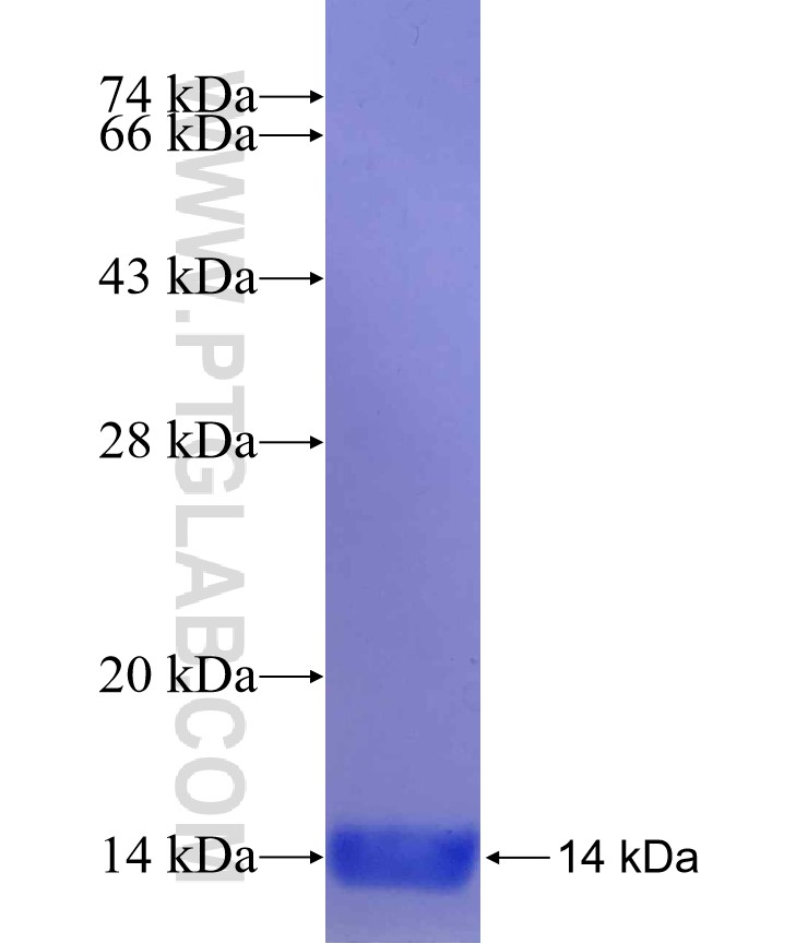 CYB561 fusion protein Ag30043 SDS-PAGE CYB561 fusion protein Ag30043 SDS-PAGE