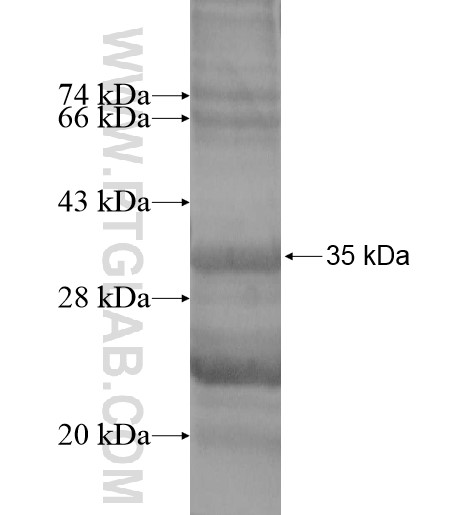 CYB561 fusion protein Ag14183 SDS-PAGE