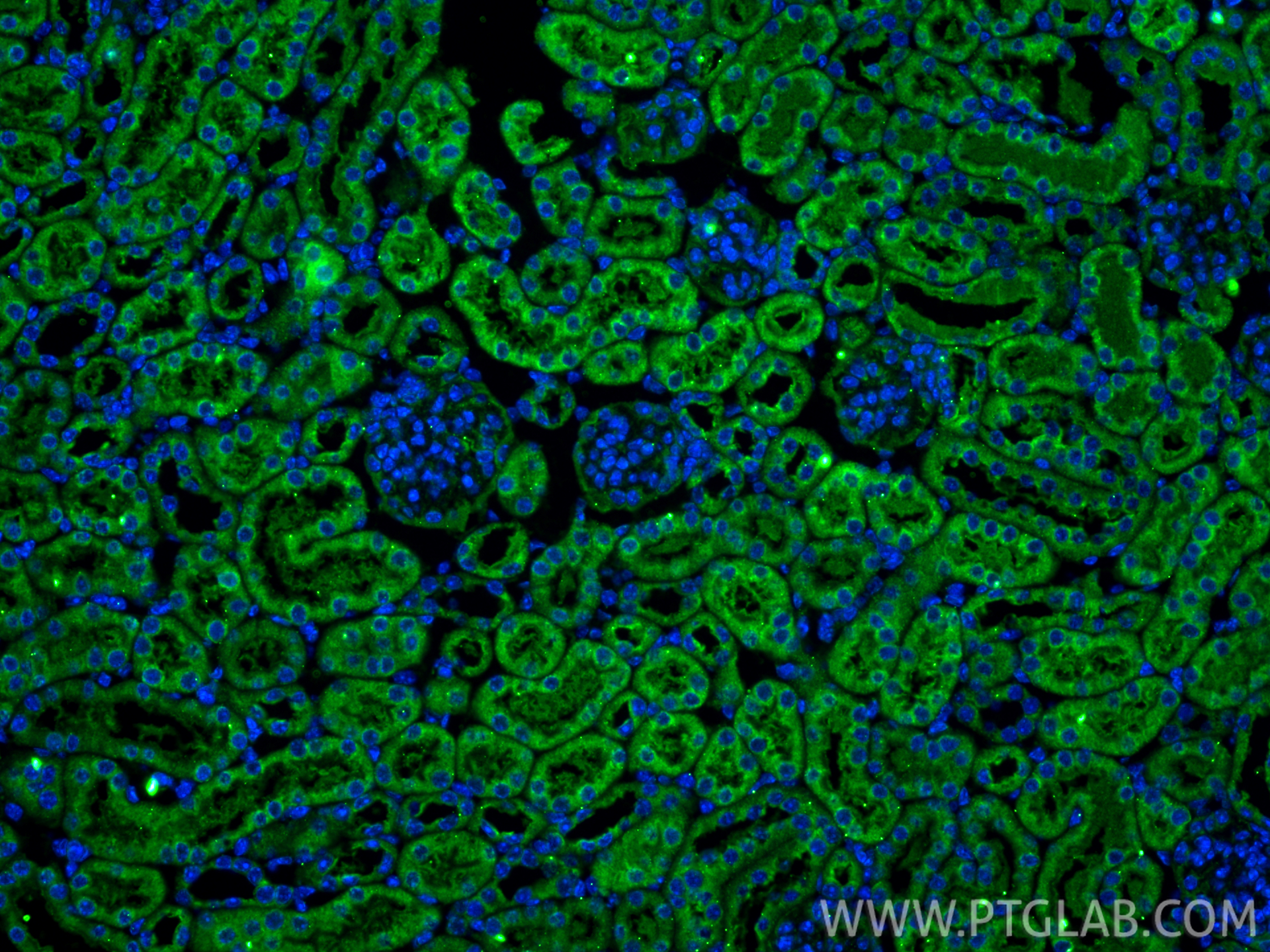 IF Staining of mouse kidney using 12626-1-AP