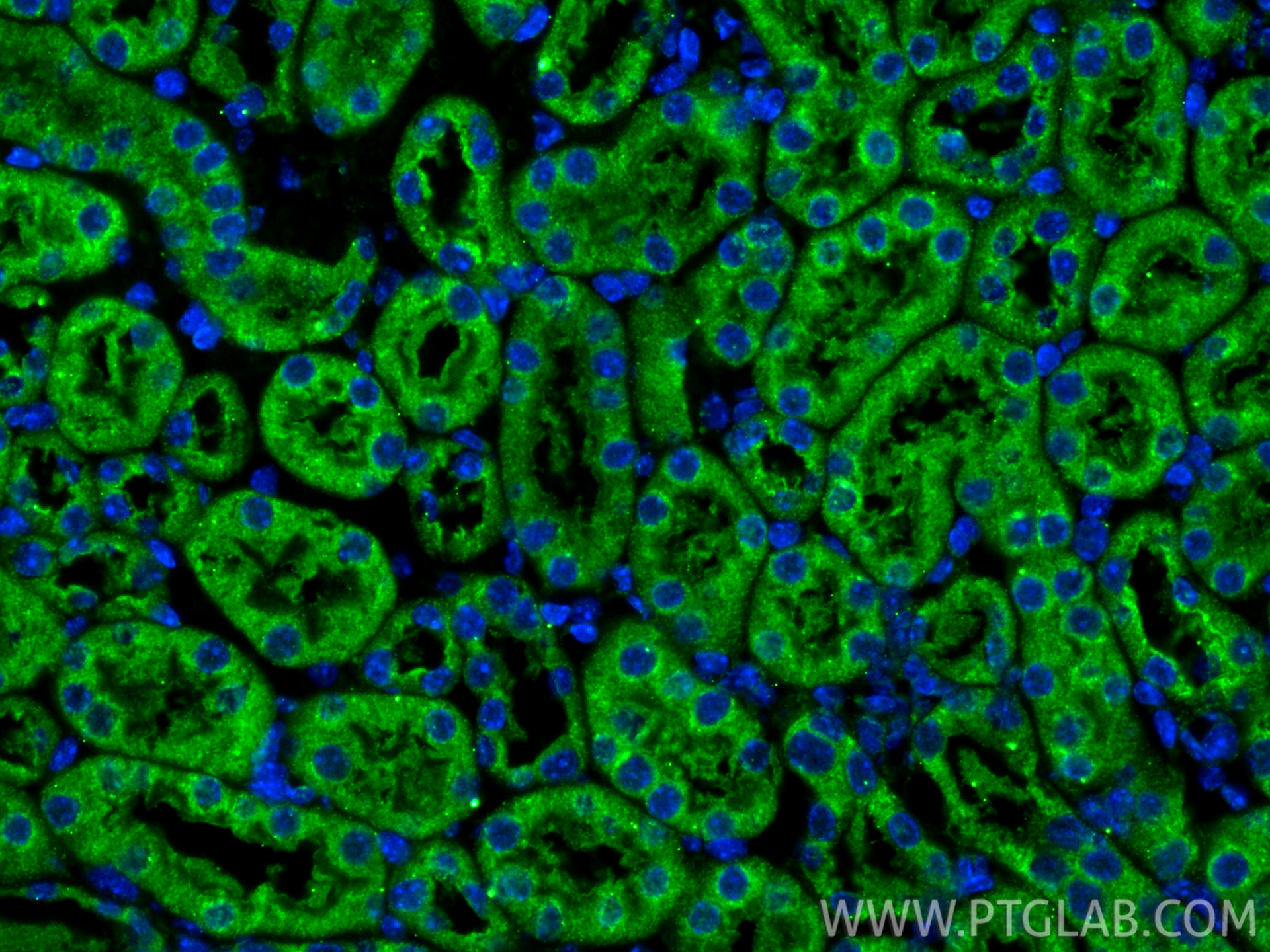 IF Staining of mouse kidney using 12626-1-AP