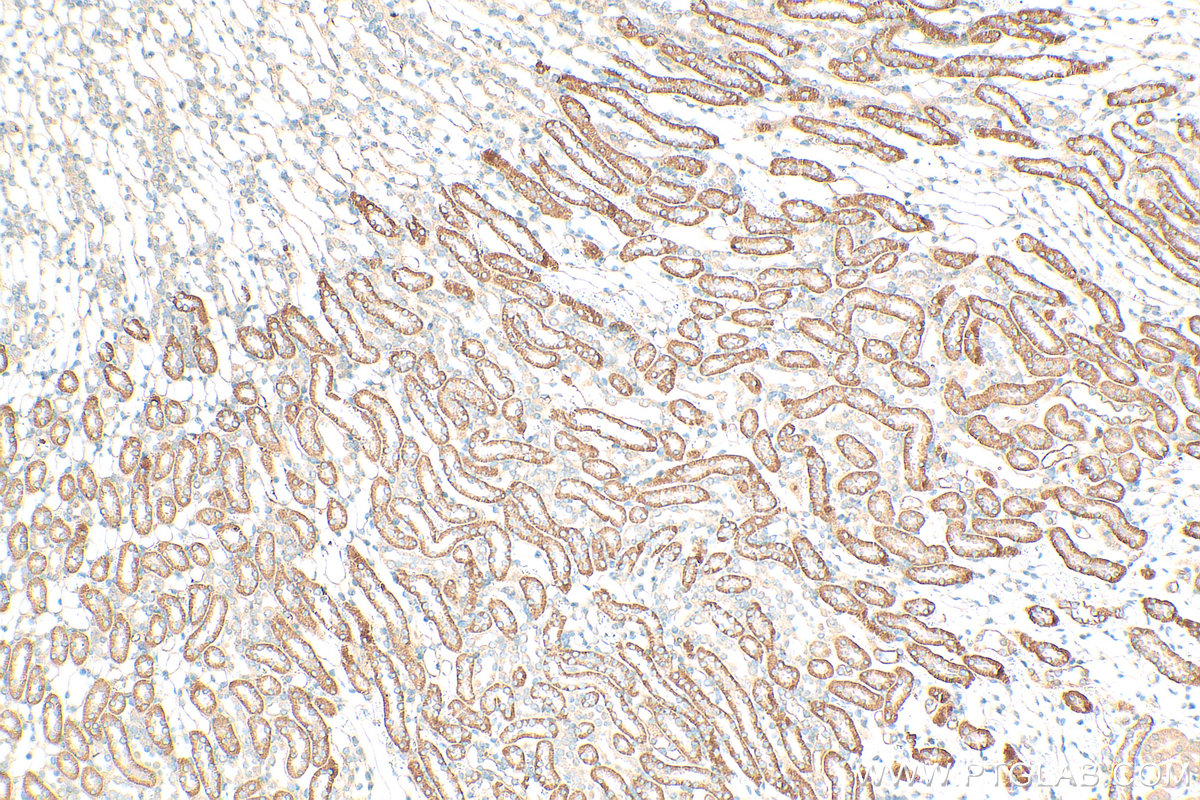 IHC staining of mouse kidney using 12626-1-AP