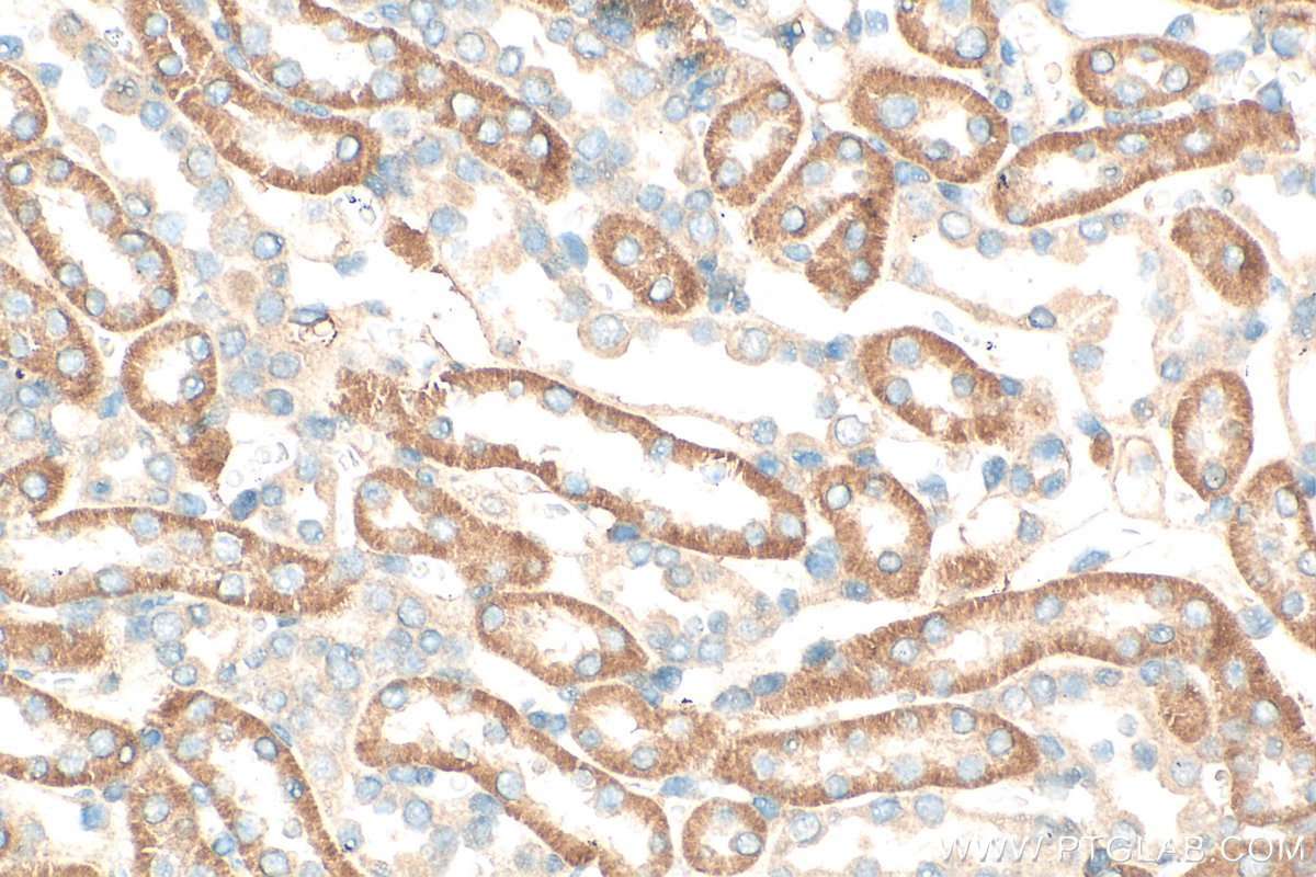 IHC staining of mouse kidney using 12626-1-AP