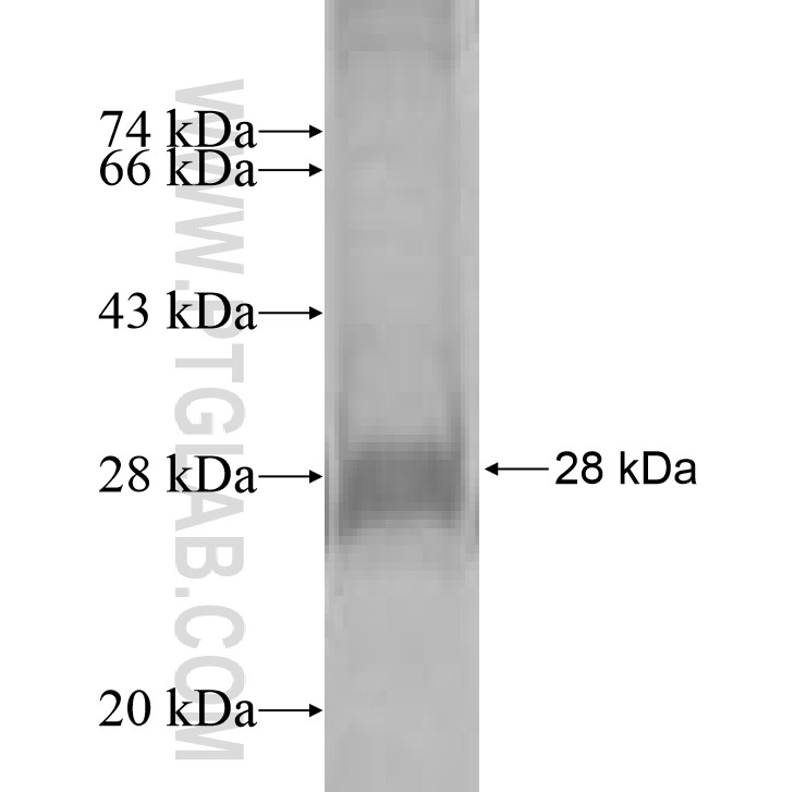 CYBASC3 fusion protein Ag9816 SDS-PAGE CYBASC3 fusion protein Ag9816 SDS-PAGE