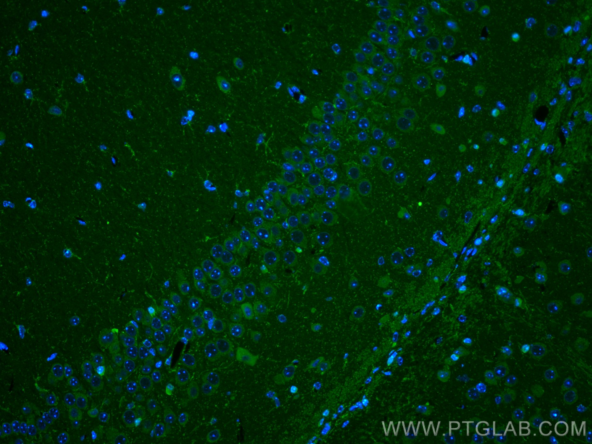 IF Staining of mouse brain using 19013-1-AP