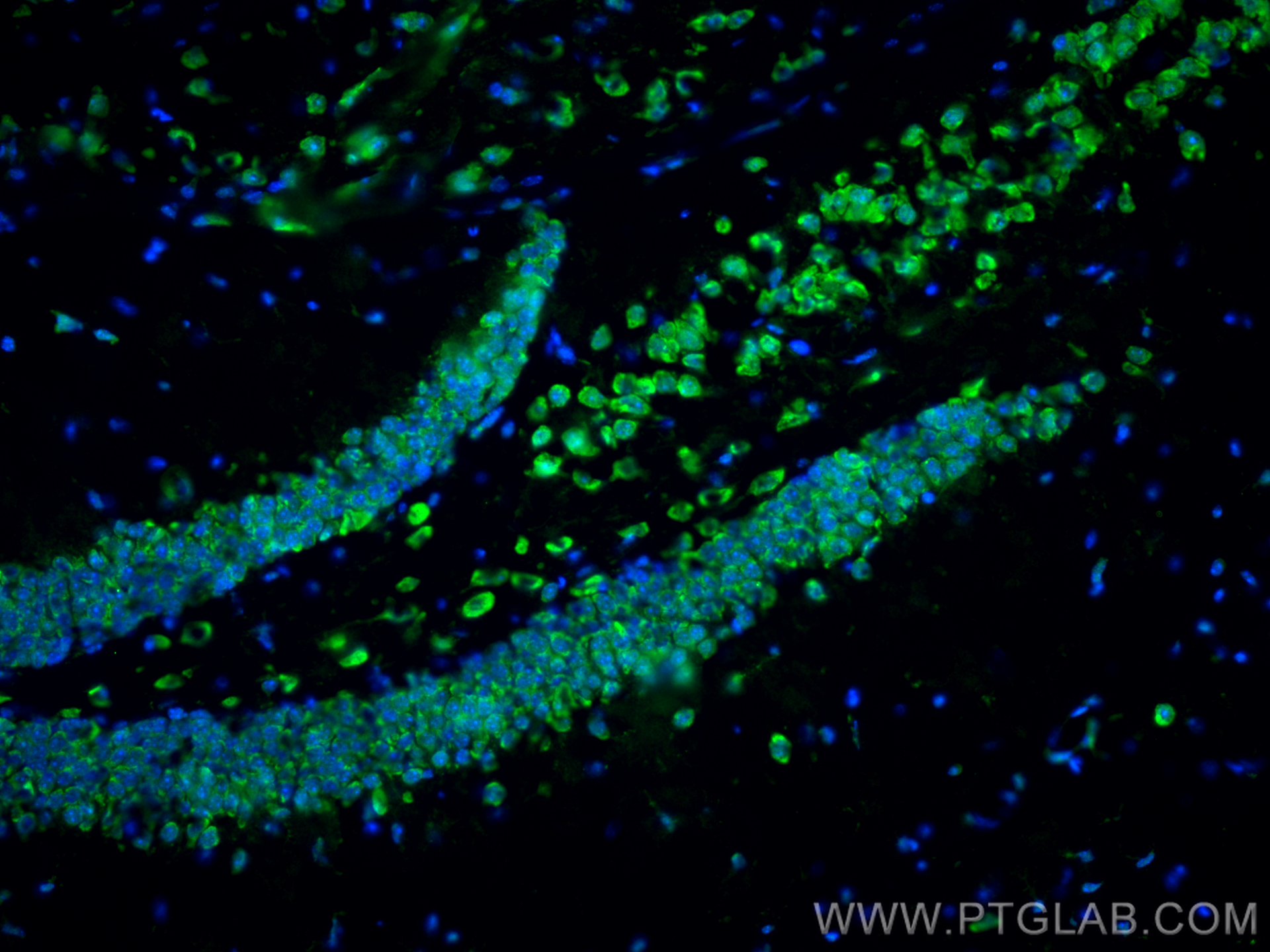 Immunofluorescent analysis of (4% PFA) fixed frozen OCT-embedded mouse brain tissue using NOX2 antibody (19013-1-AP) at dilution of 1:400 and CoraLite®488-Conjugated Goat Anti-Rabbit IgG(H+L) (<a class='green' href='/productredirect?CatalogNo=SA00013-2' target='_blank'>SA00013-2</a>). IF Staining of mouse brain using 19013-1-AP