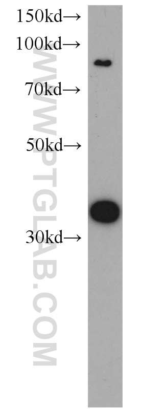 CYC1 Polyclonal antibody