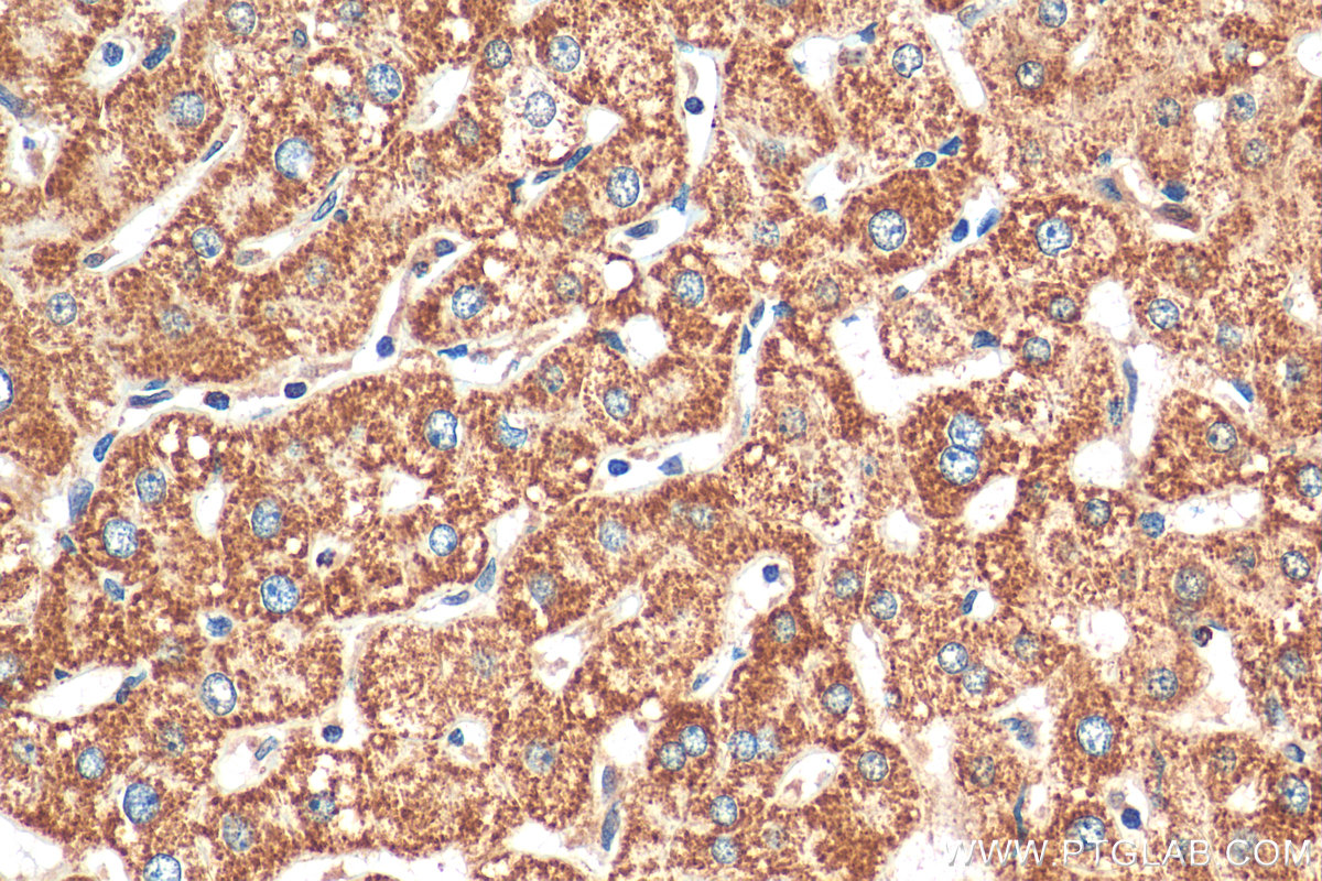 IHC staining of human liver using 10993-1-AP