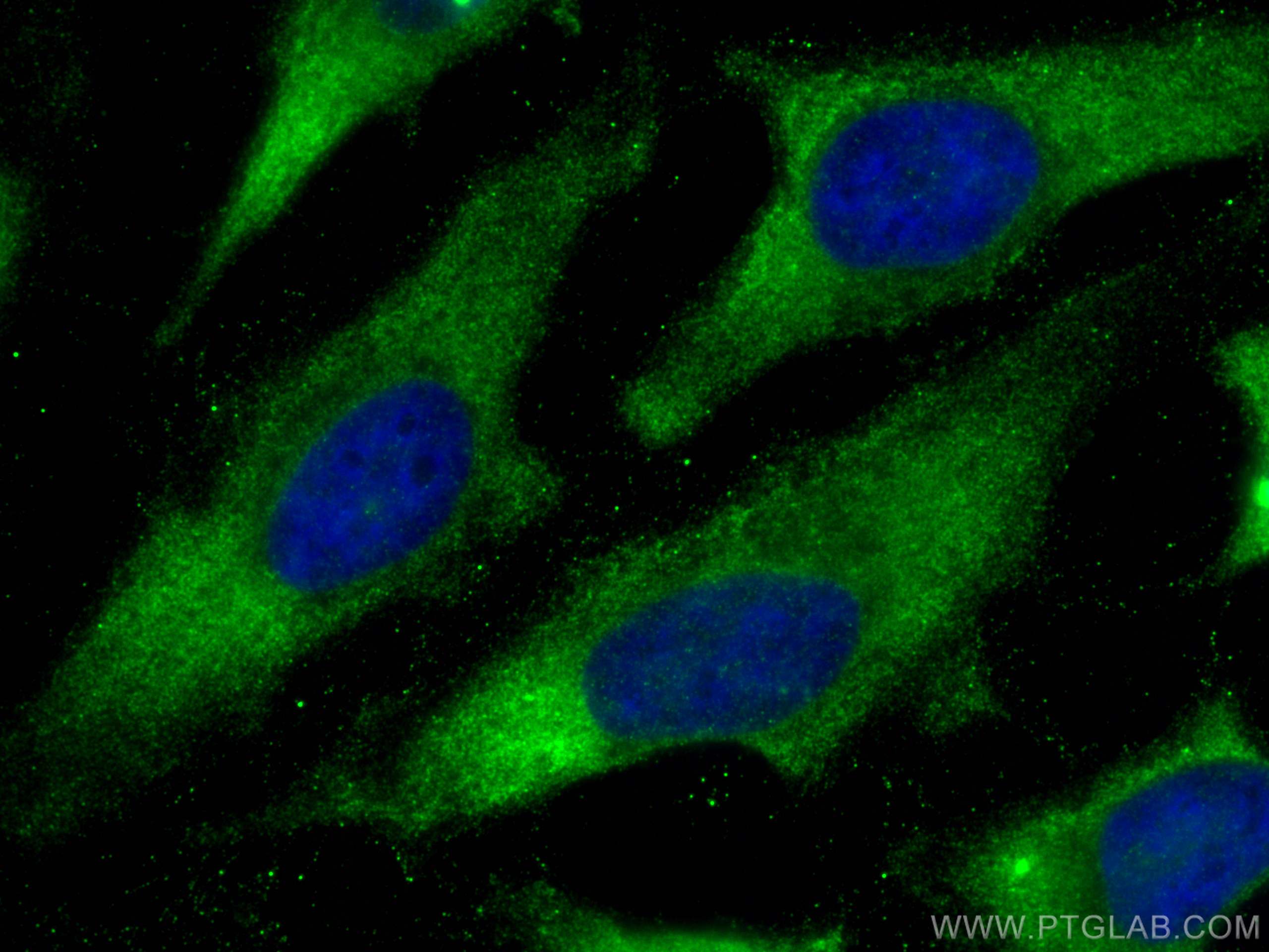 IF Staining of HeLa using 27925-1-AP