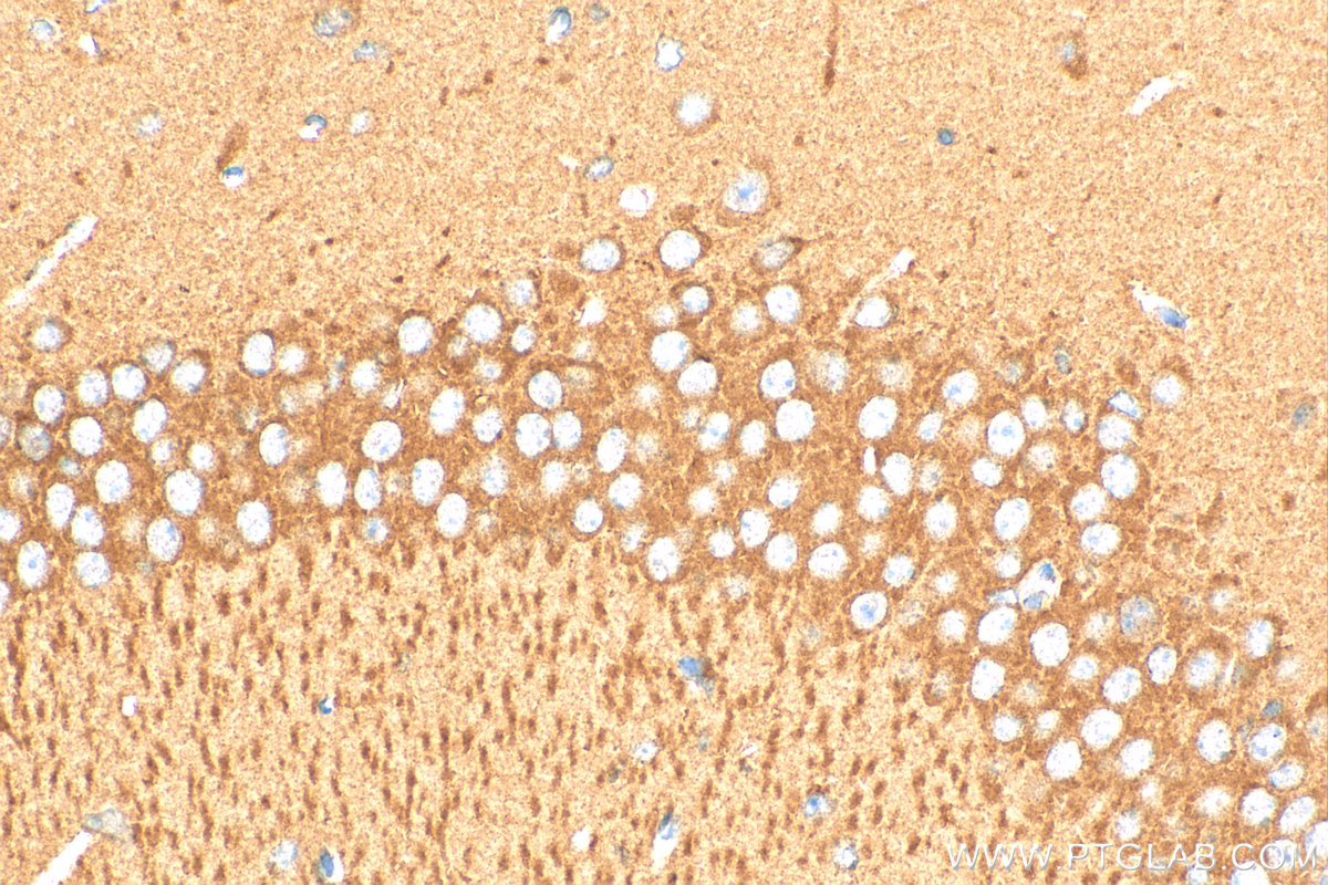 IHC staining of mouse brain using 16011-1-AP