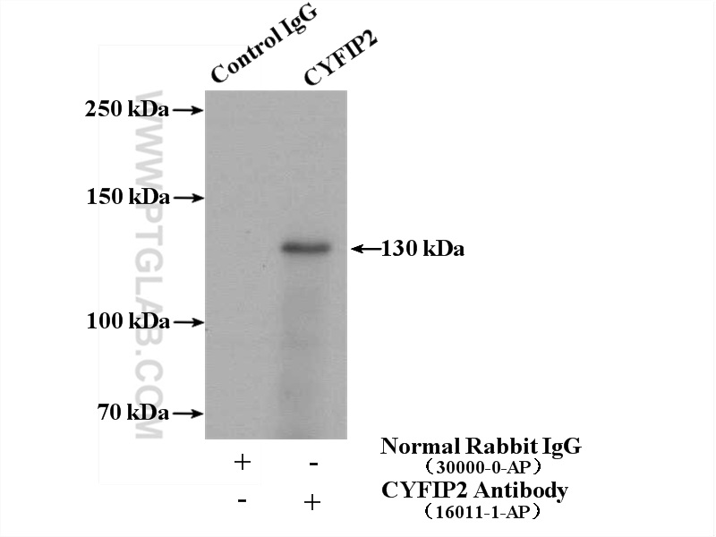 IP experiment of mouse brain using 16011-1-AP