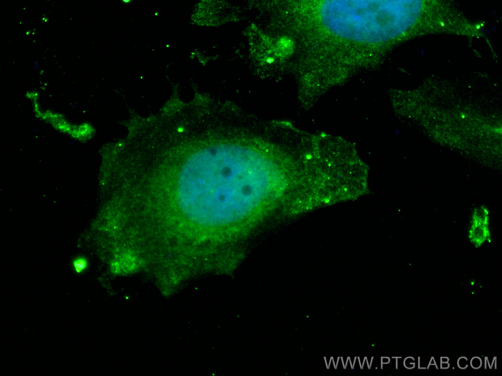 IF Staining of HeLa using 60228-1-Ig