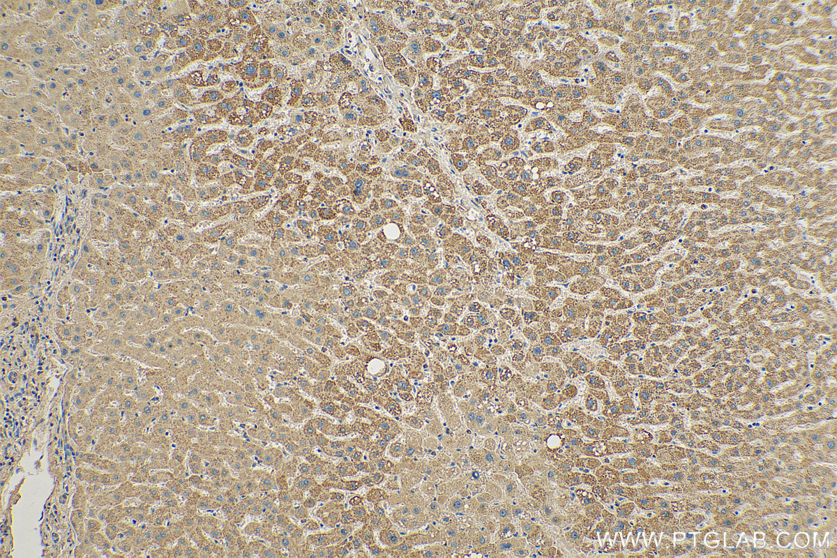 IHC staining of human liver using 60228-1-Ig