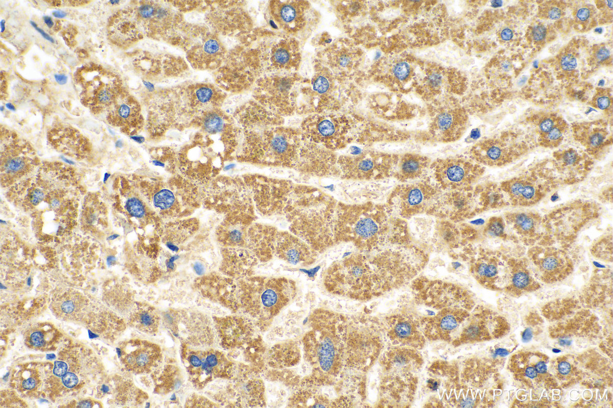 IHC staining of human liver using 60228-1-Ig