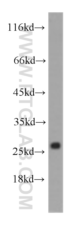 WB analysis of human heart using 60228-1-Ig