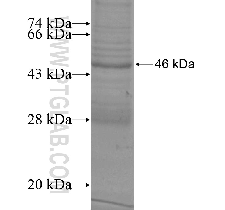 CYHR1 fusion protein Ag14679 SDS-PAGE