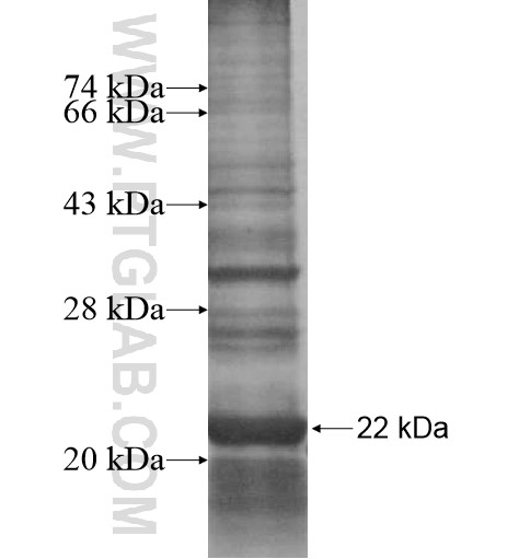 CYHR1 fusion protein Ag15220 SDS-PAGE CYHR1 fusion protein Ag15220 SDS-PAGE