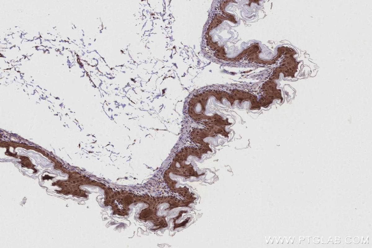 IHC staining of mouse stomach using 11110-1-AP IHC staining of mouse stomach using 11110-1-AP