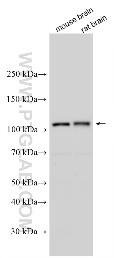 Various lysates were subjected to SDS PAGE followed by western blot with 11110-1-AP (CYLD antibody) at dilution of 1:2000 incubated at room temperature for 1.5 hours. WB analysis using 11110-1-AP
