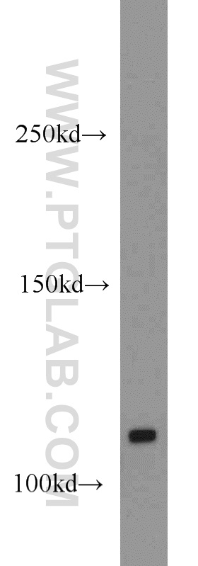 CYLD Polyclonal antibody