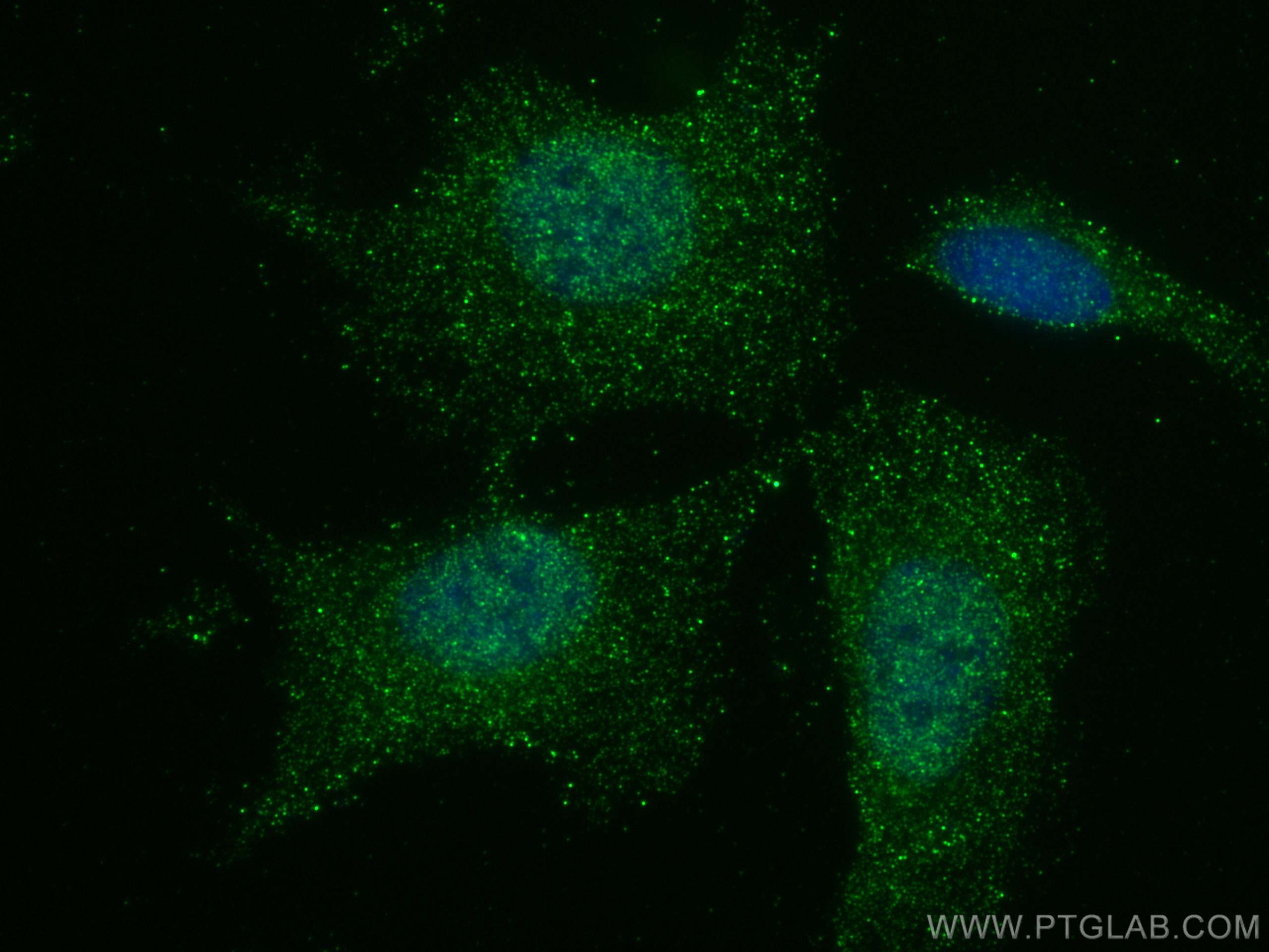 IF Staining of SH-SY5Y using 66858-1-Ig