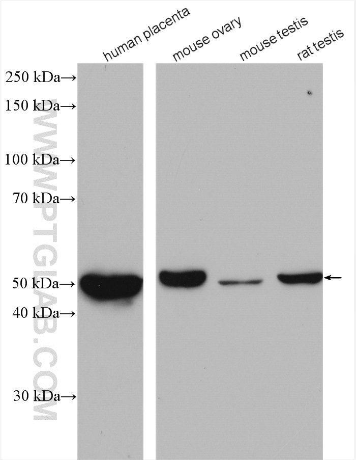 WB analysis using 13363-1-AP