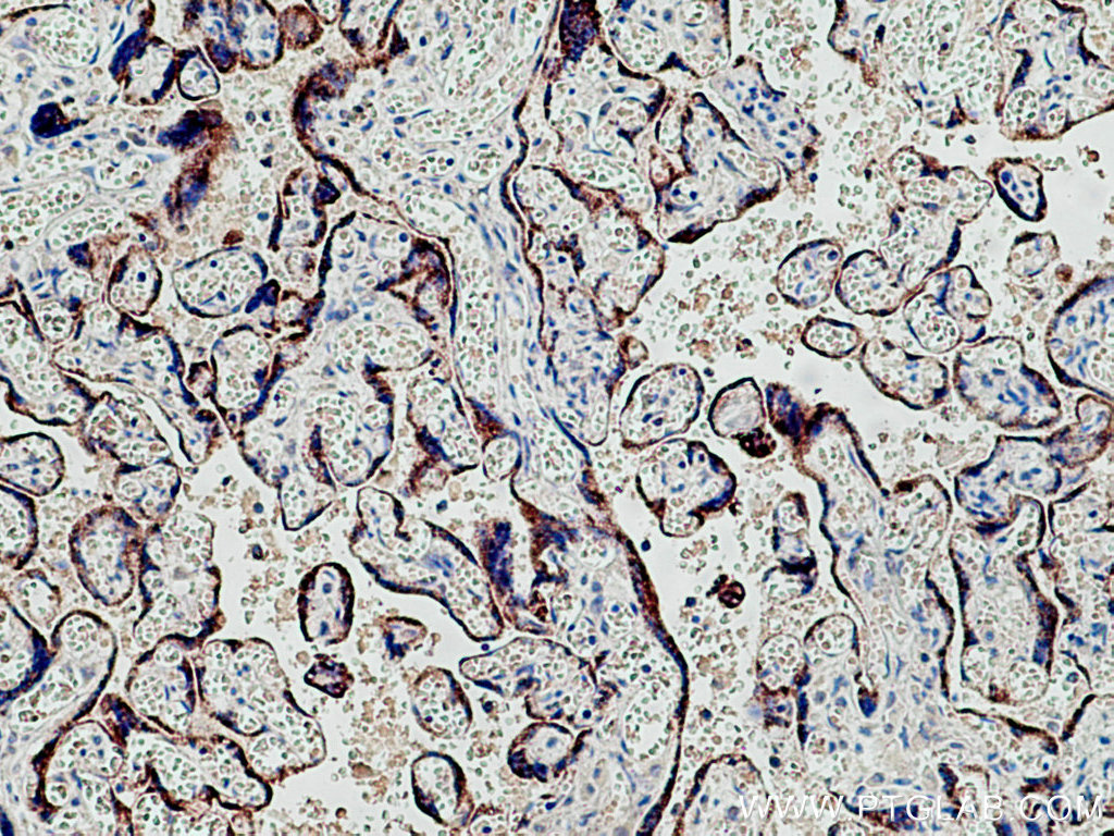 IHC staining of human placenta using 67264-1-Ig