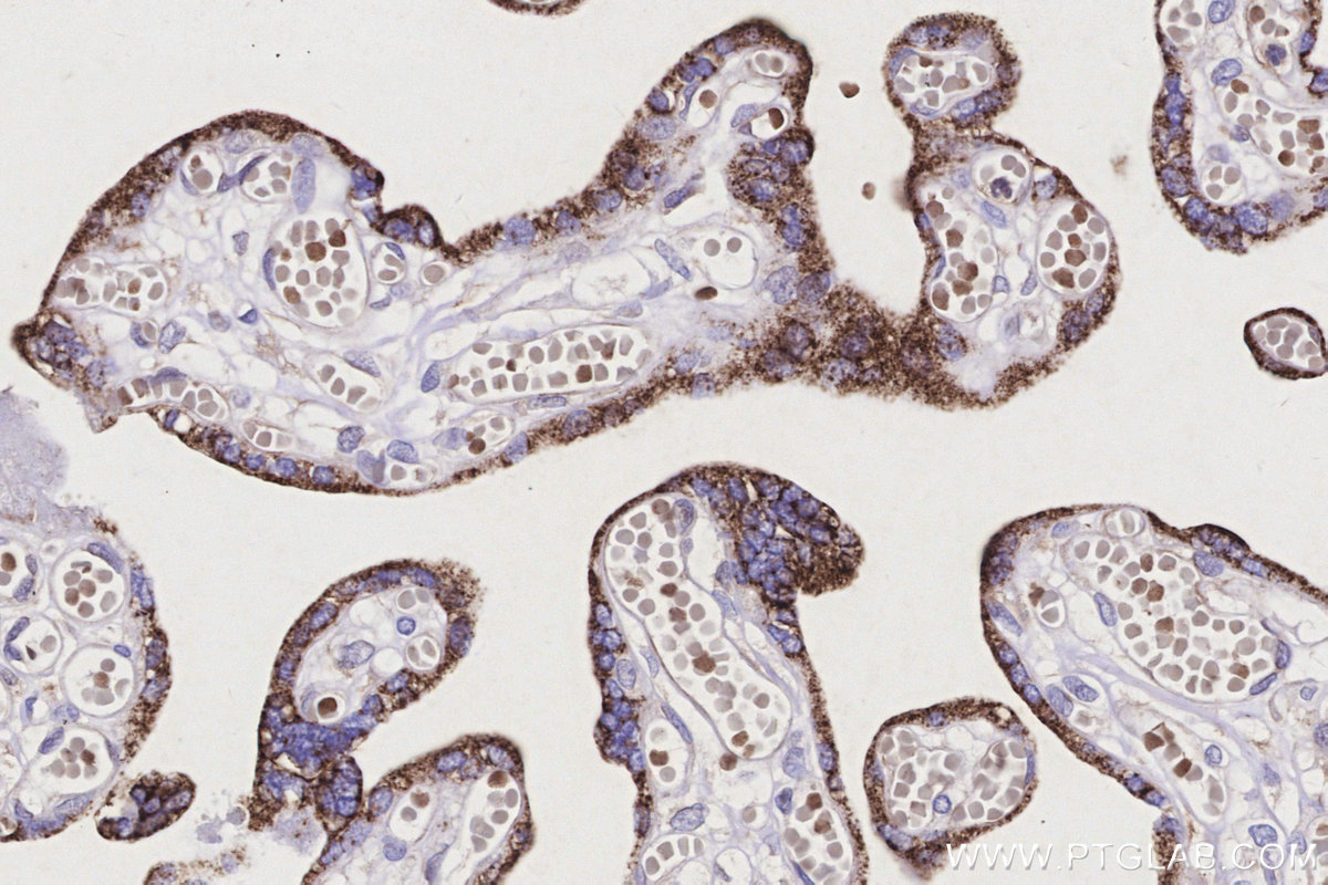 IHC staining of human placenta using 67264-1-Ig
