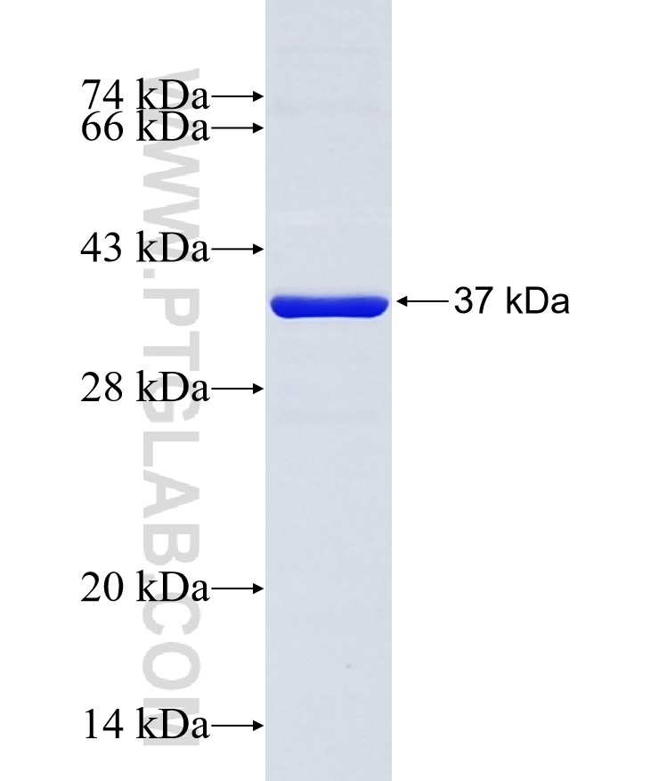 CYP11A1 fusion protein Ag4353 SDS-PAGE