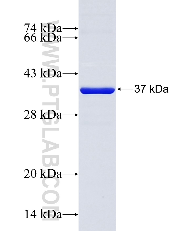 CYP11A1 fusion protein Ag4353 SDS-PAGE