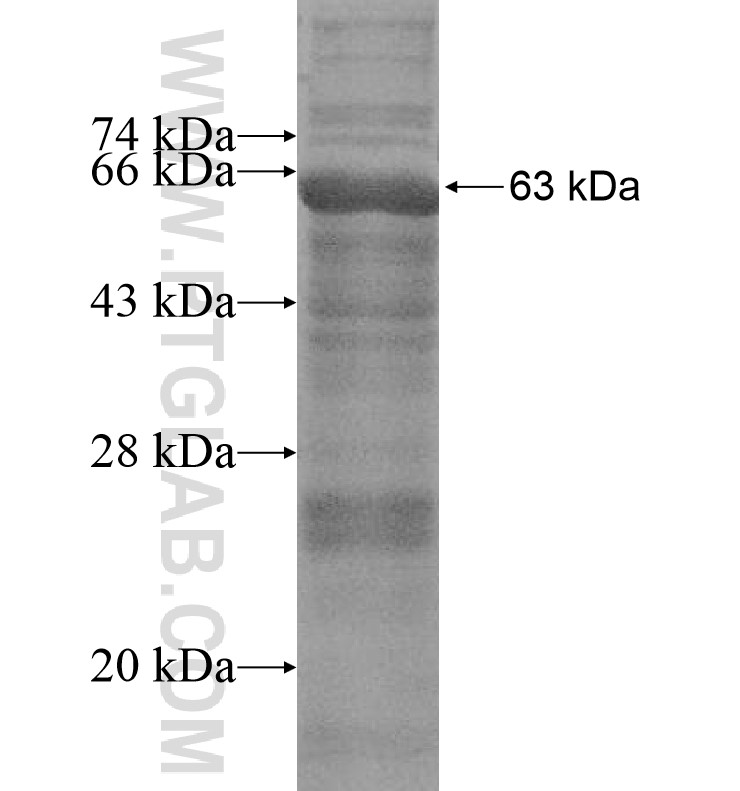 CYP11B1 fusion protein Ag16382 SDS-PAGE CYP11B1 fusion protein Ag16382 SDS-PAGE