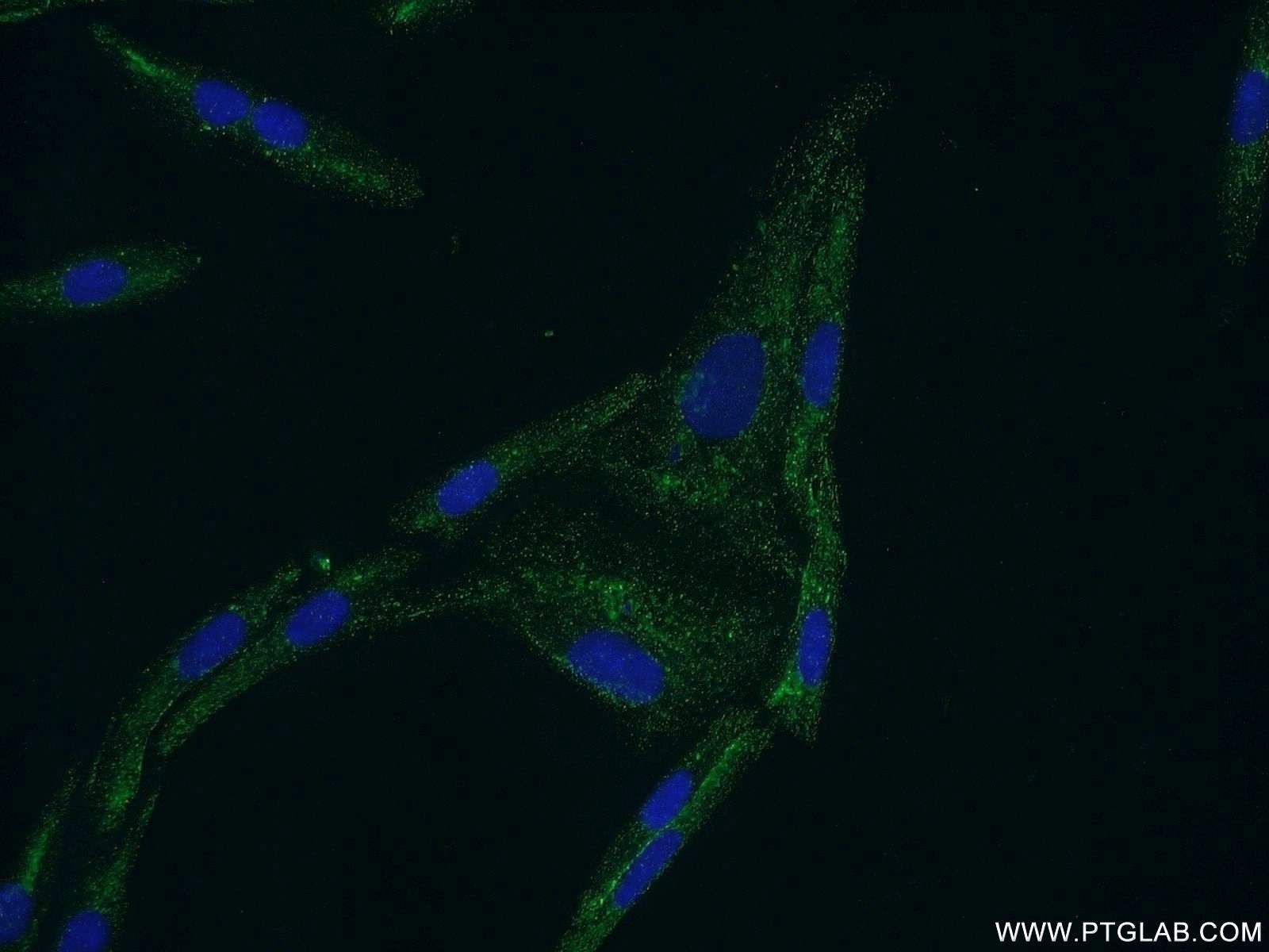 IF Staining of SKOV-3 using 20968-1-AP