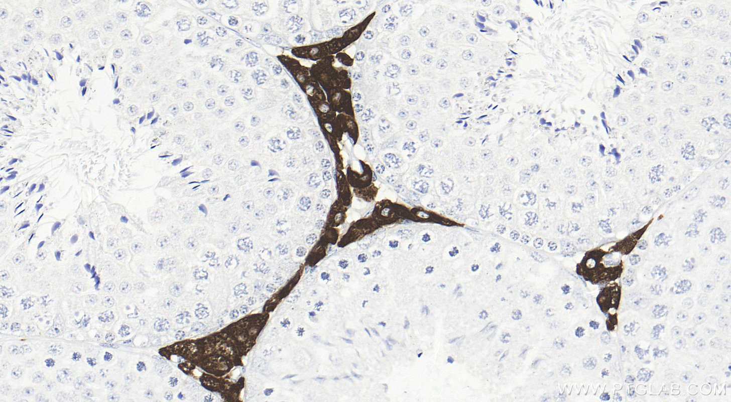 IHC staining of mouse testis using 85690-5-RR