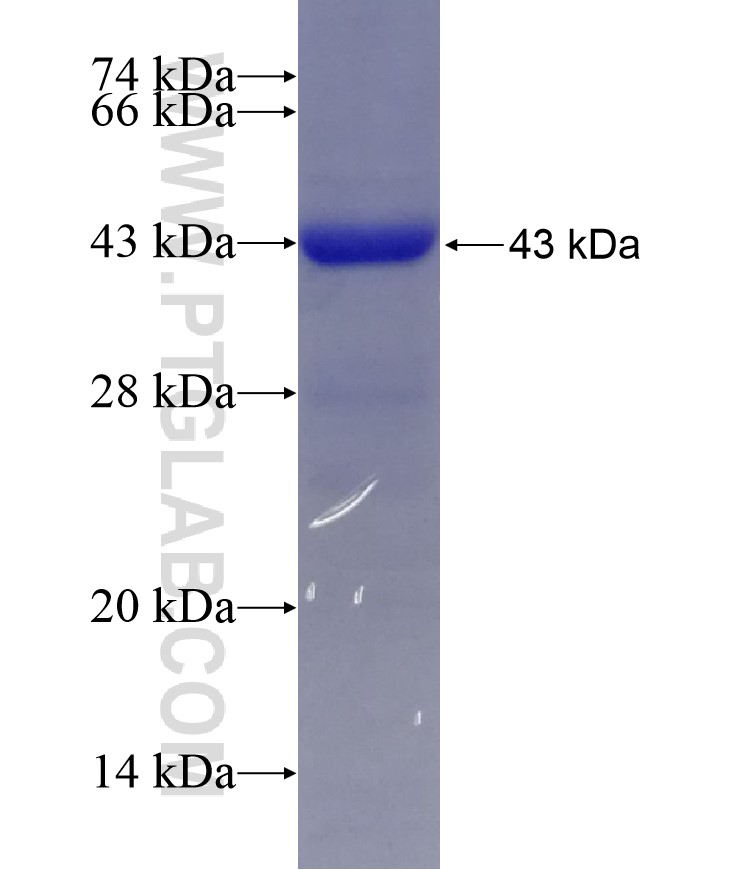 CYP17A1 fusion protein Ag5998 SDS-PAGE