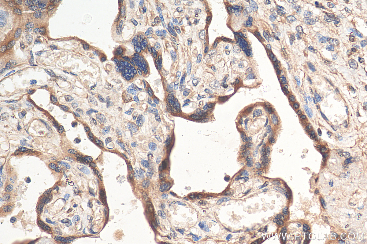 IHC staining of human placenta using 16554-1-AP