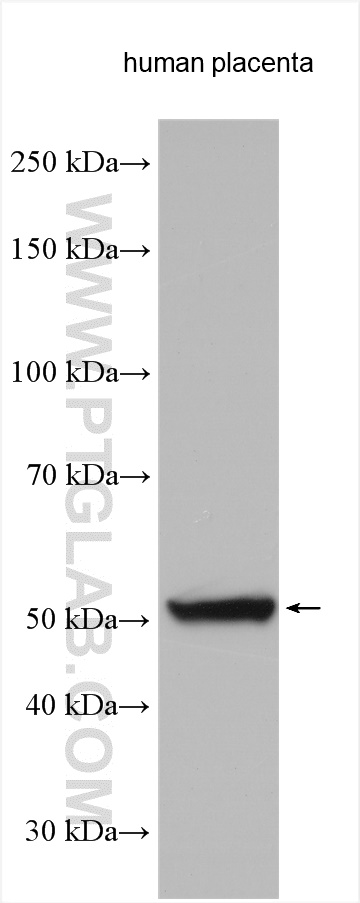 WB analysis of human placenta using 16554-1-AP