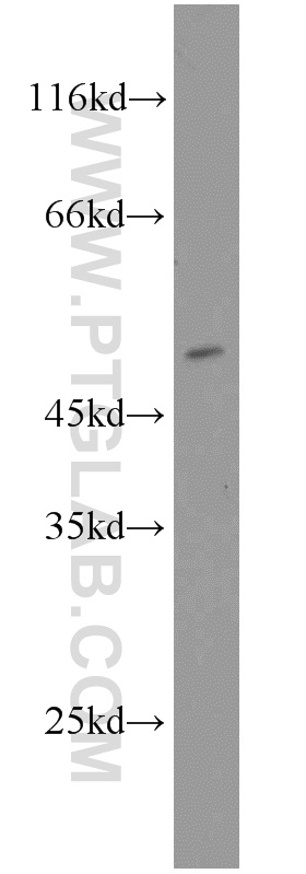 WB analysis of A2780 using 16554-1-AP