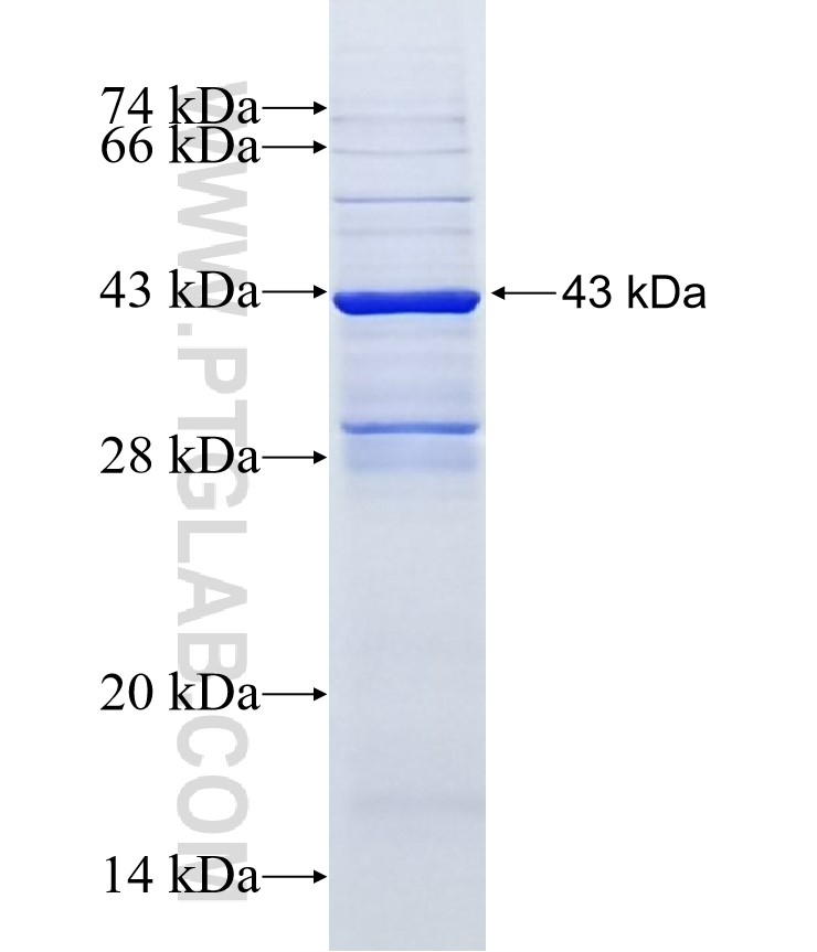 CYP19A1 fusion protein Ag9765 SDS-PAGE