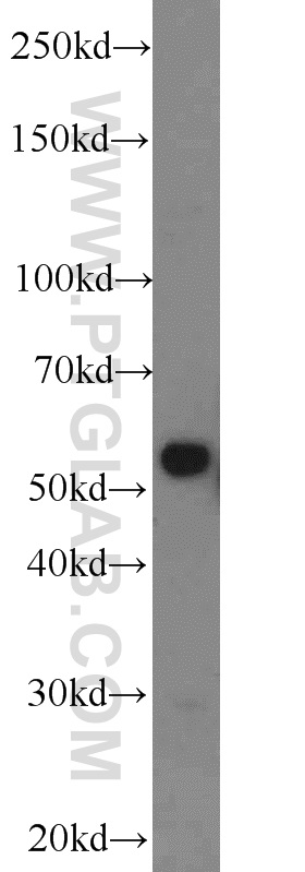 WB analysis of mouse cerebellum using 13241-1-AP