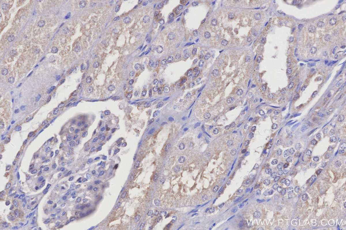 IHC staining of human kidney using 19936-1-AP IHC staining of human kidney using 19936-1-AP