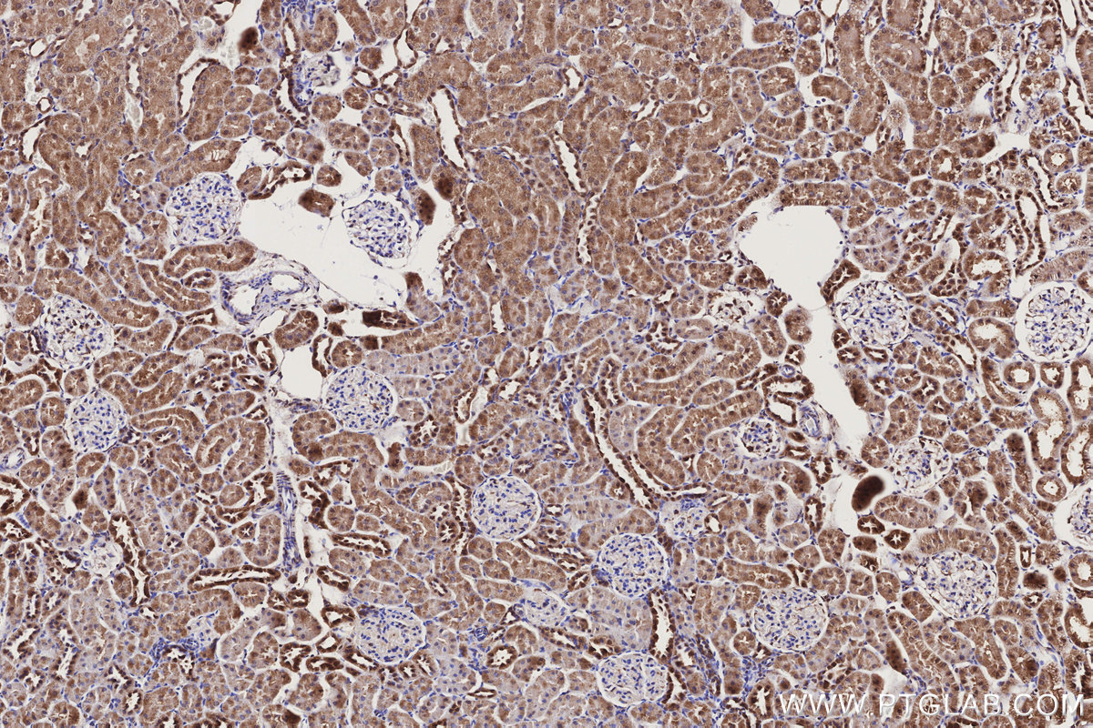 IHC staining of rat kidney using 19936-1-AP IHC staining of rat kidney using 19936-1-AP