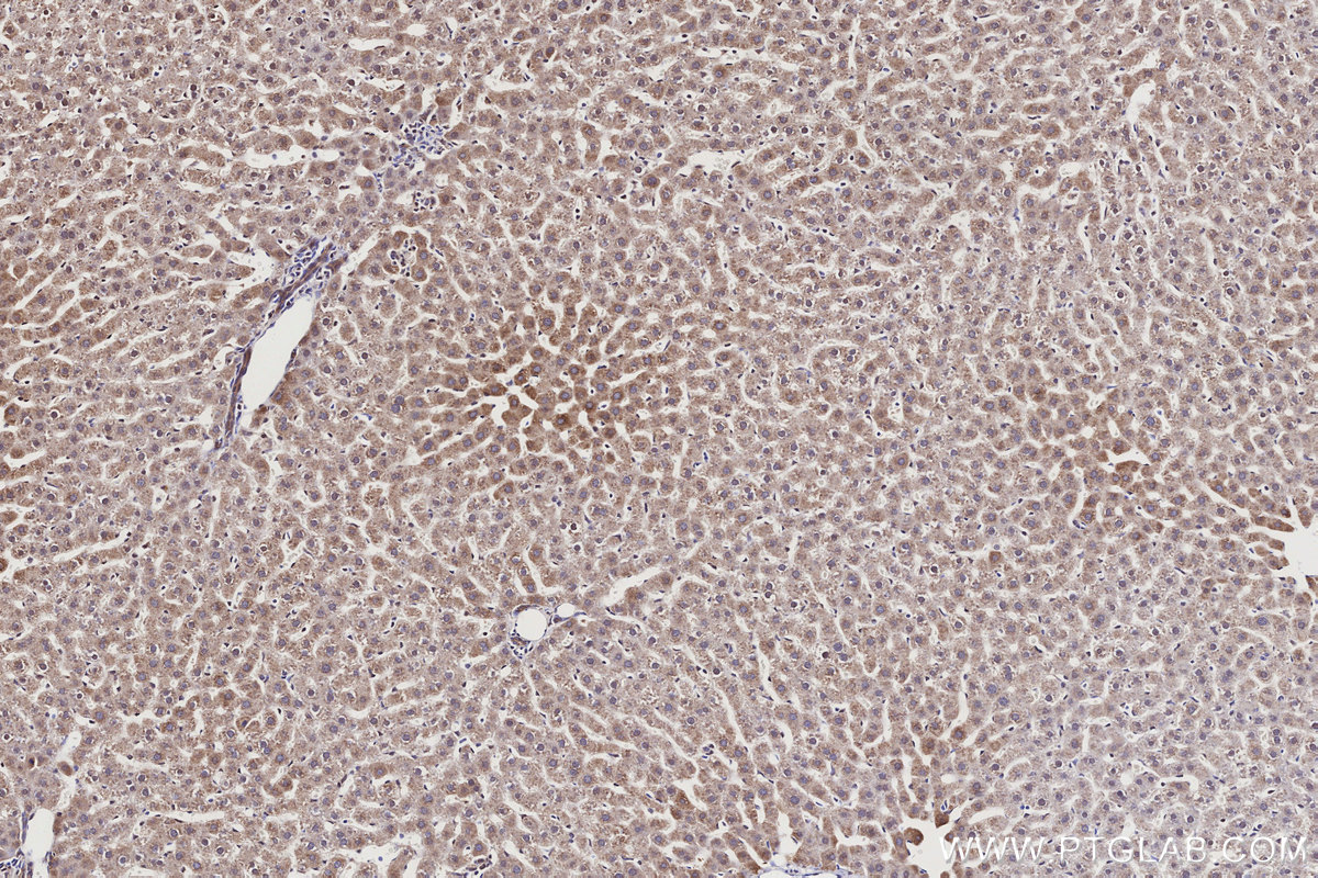 IHC staining of rat liver using 19936-1-AP IHC staining of rat liver using 19936-1-AP