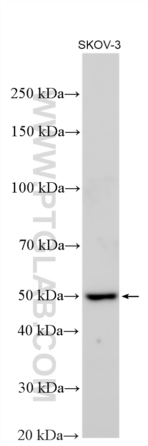 Various lysates were subjected to SDS PAGE followed by western blot with 18505-1-AP (CYP1B1 antibody) at dilution of 1:1000 incubated at room temperature for 1.5 hours. WB analysis using 18505-1-AP