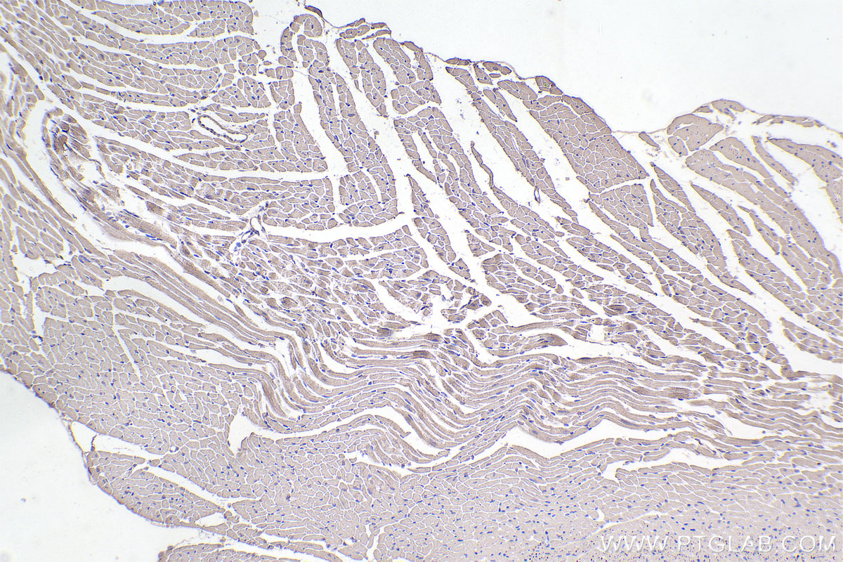 IHC staining of mouse heart using 67033-1-Ig
