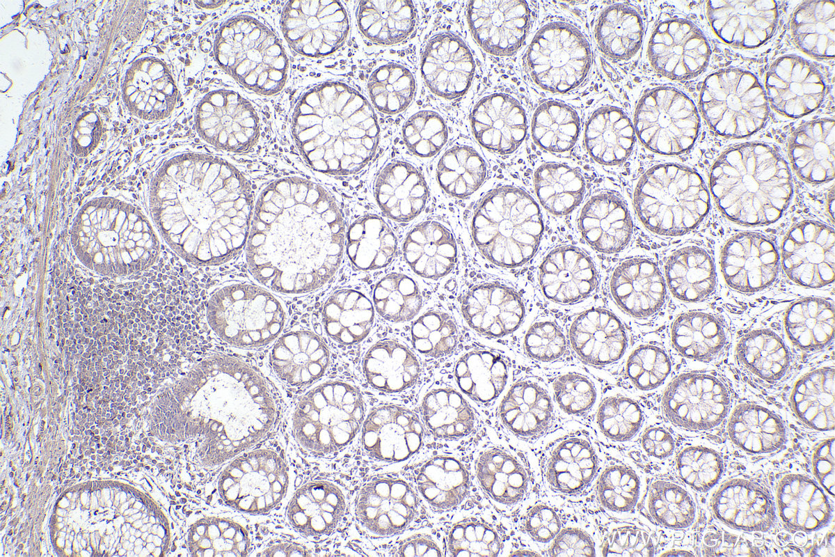 CYP1B1