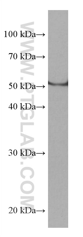 CYP1B1