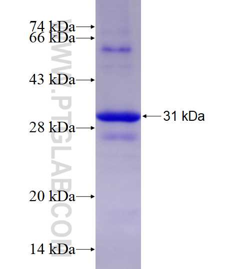 CYP1B1 fusion protein Ag13380 SDS-PAGE