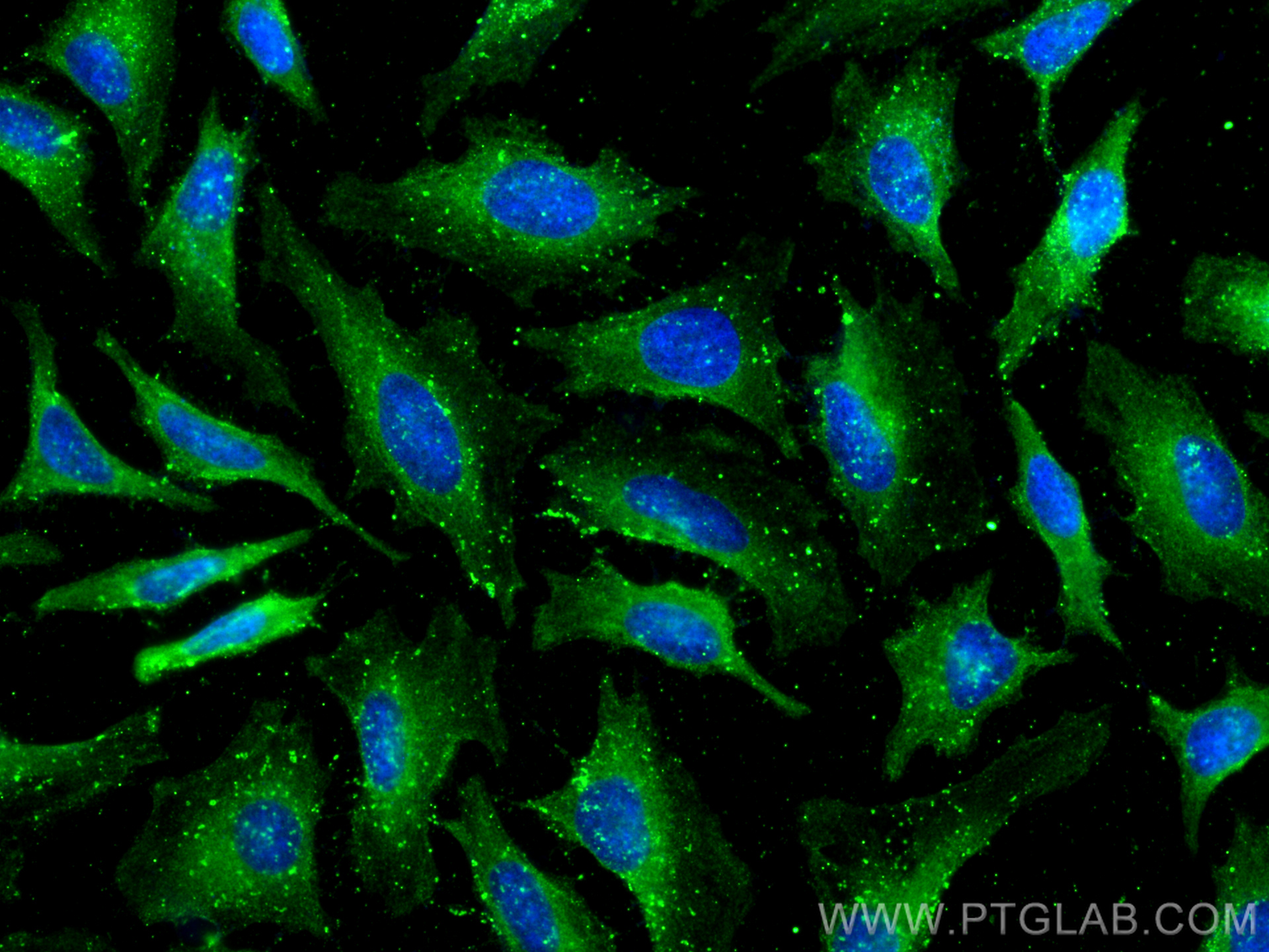 IF Staining of HeLa using 67433-1-Ig (same clone as 67433-1-PBS)