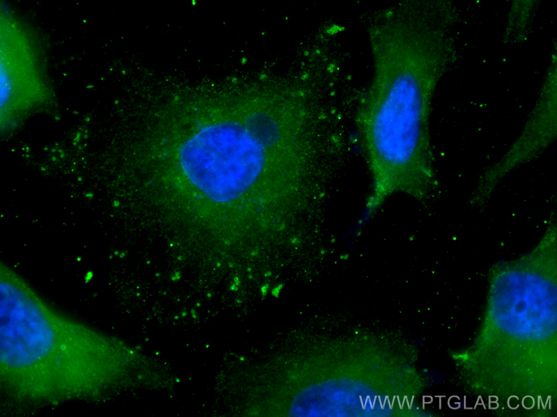 IF Staining of HeLa using 67433-1-Ig (same clone as 67433-1-PBS)