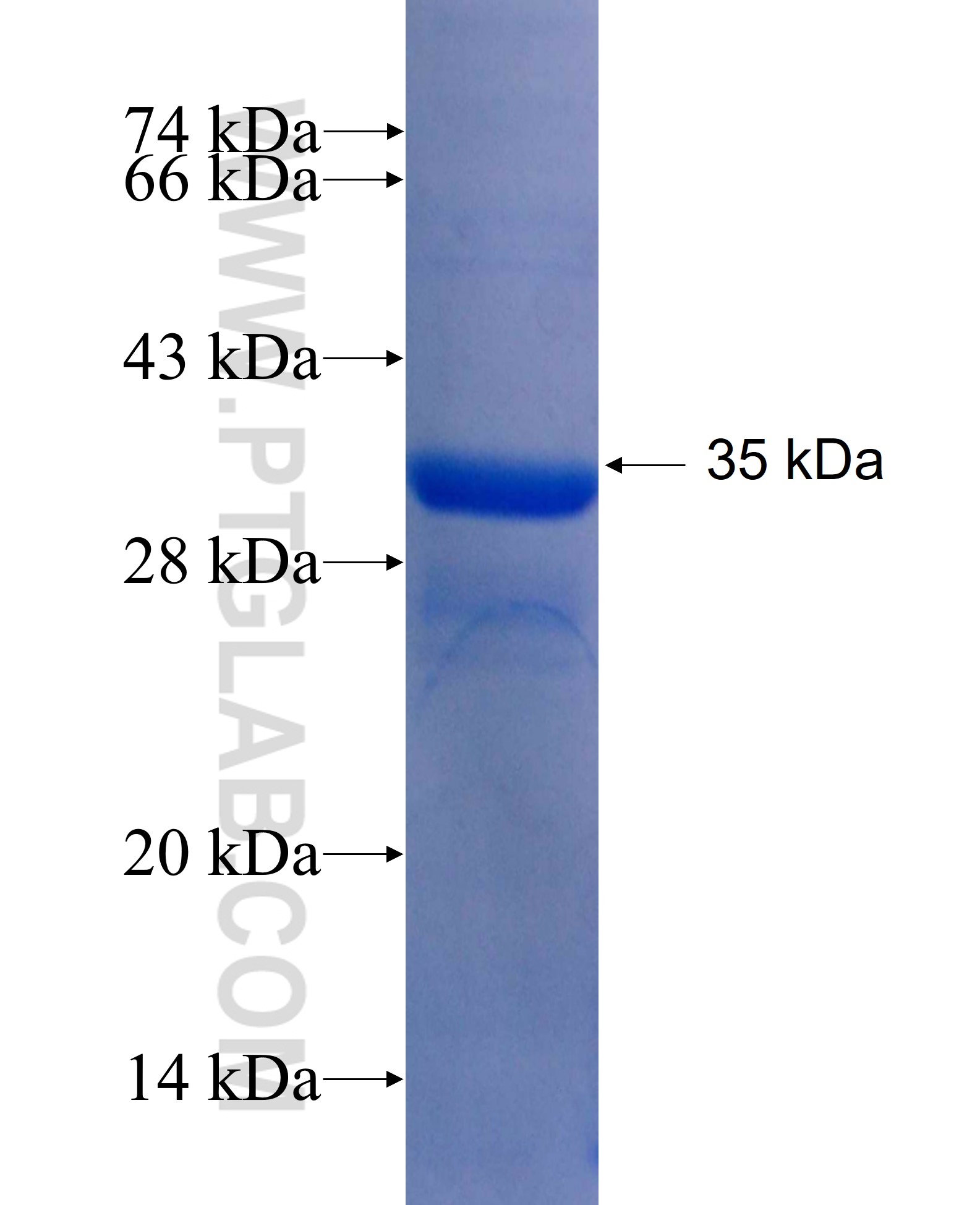 CYP21A2 fusion protein Ag26276 SDS-PAGE